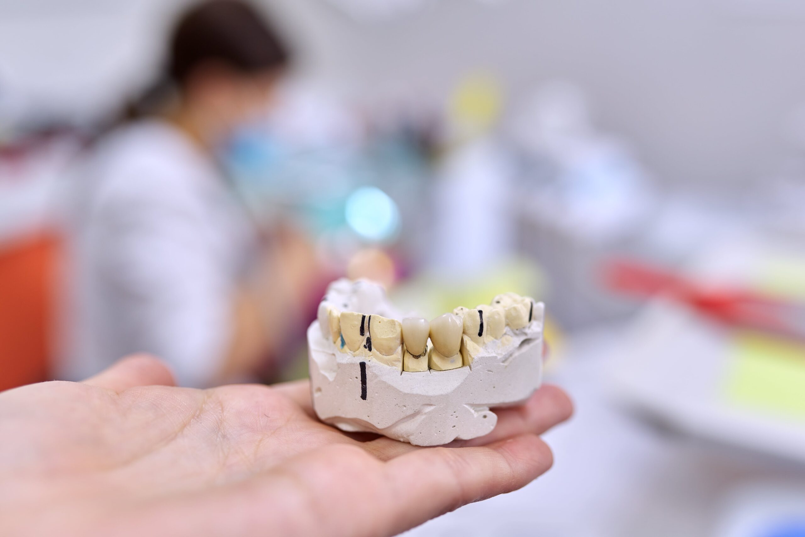 What to Know About an Infected Dental Crown?
