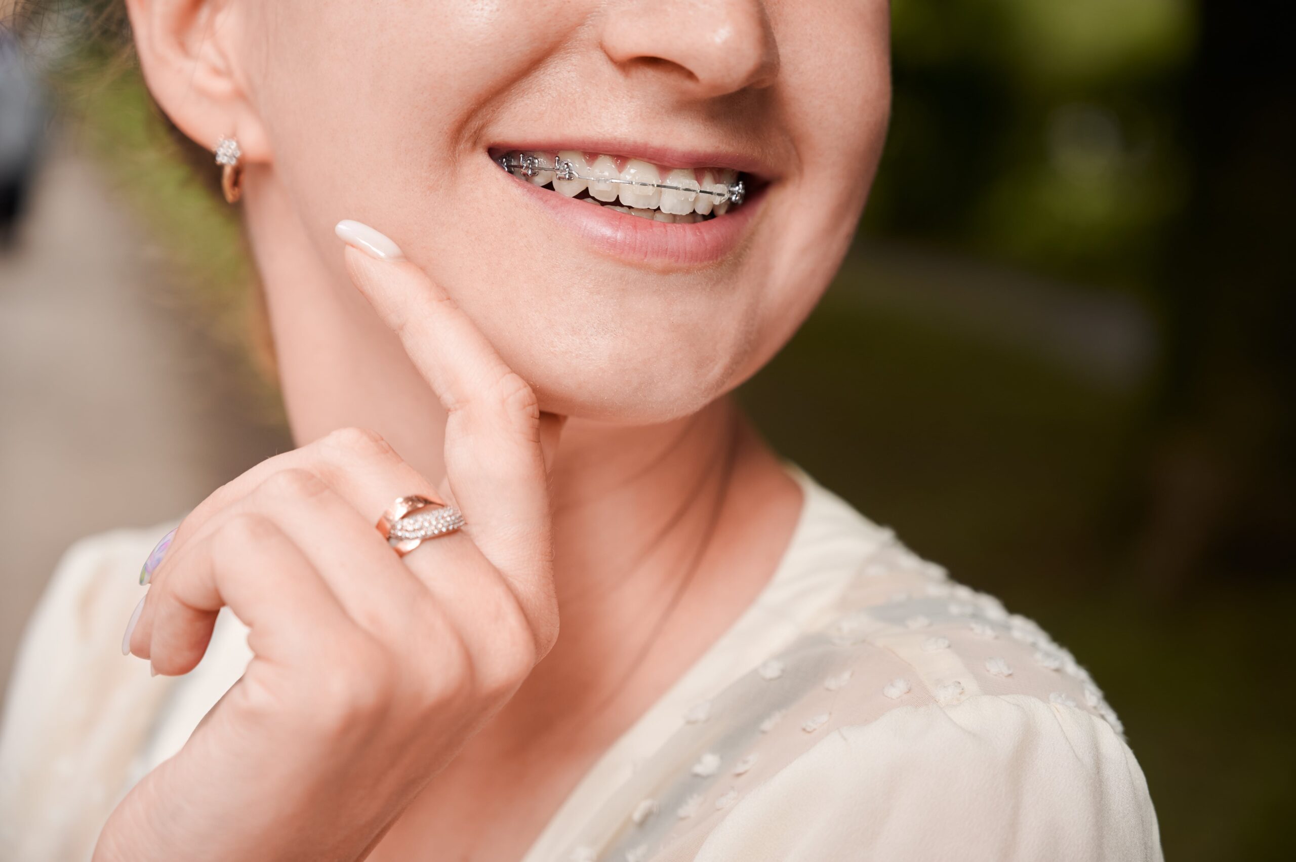 Uneven Edges After Braces