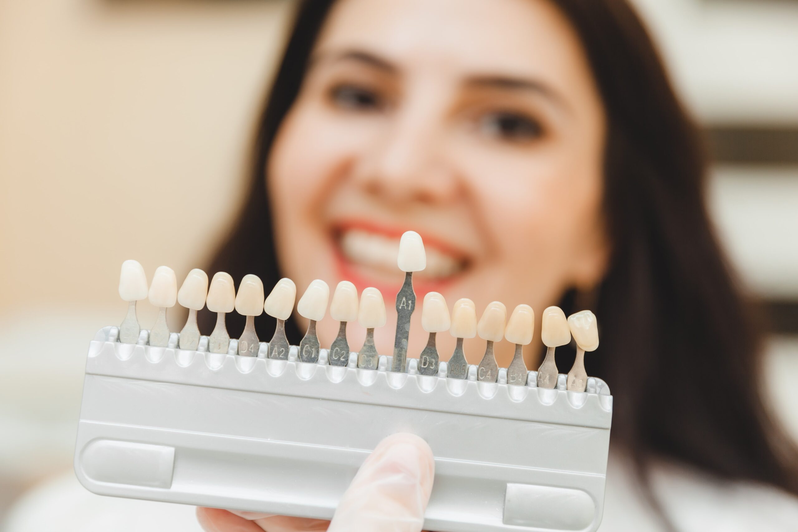 Should You Consider Veneers After Orthodontic Treatment?